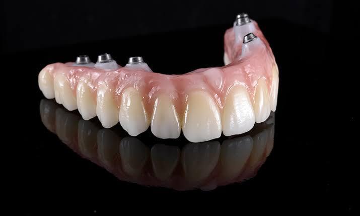Protocolo sobre implantes